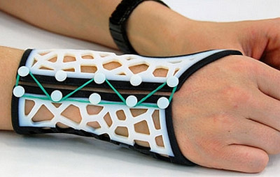 Now, 3D printed sleek wrist splints for arthritis sufferers