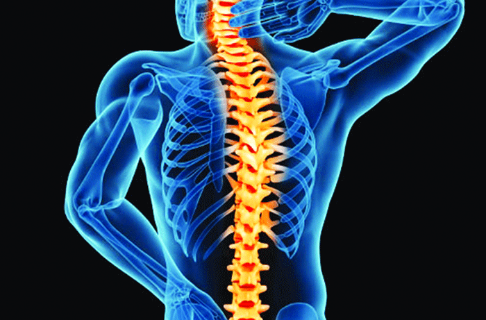 Back pain, numbness can be signs of spinal stenosis