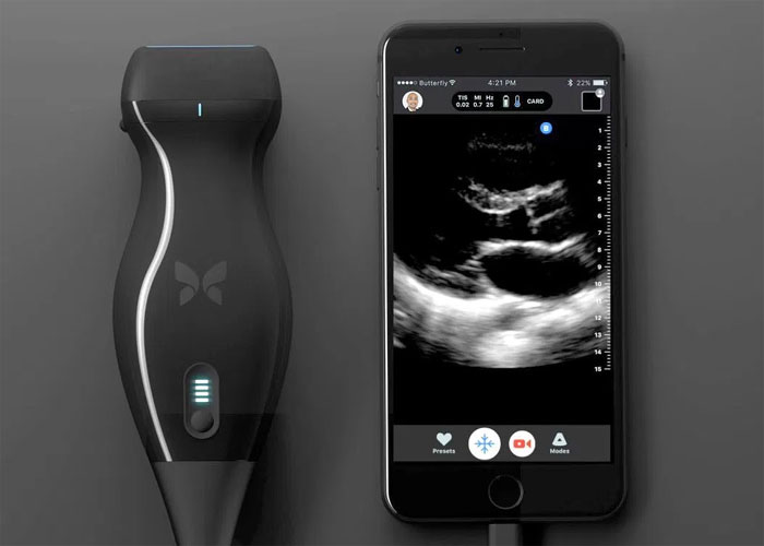 This iPhone-based ultrasound machine can detect cancer