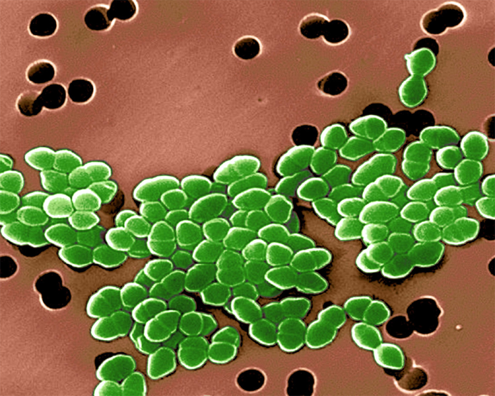 'New antibiotic to combat drug-resistant TB found in soil'