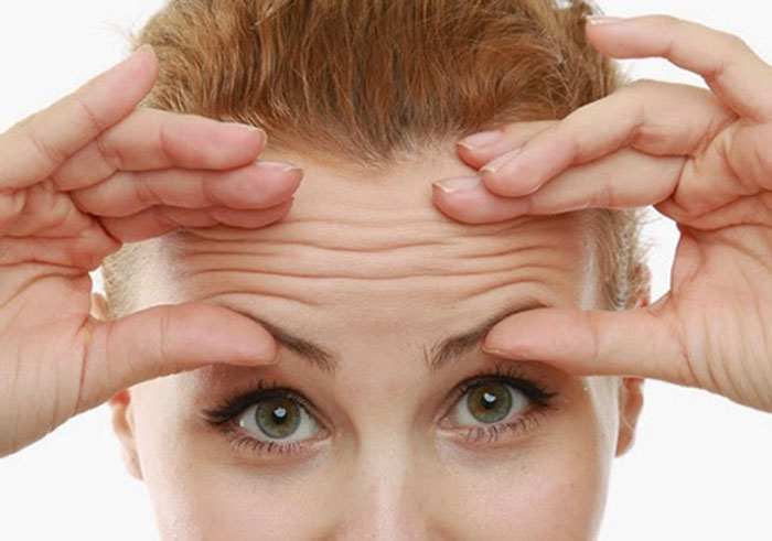 Deep forehead wrinkles may signal heart disease risk