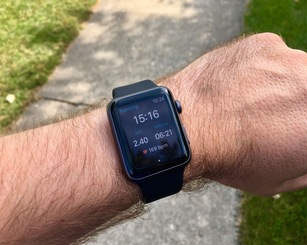 Run ecg on apple watch on sale