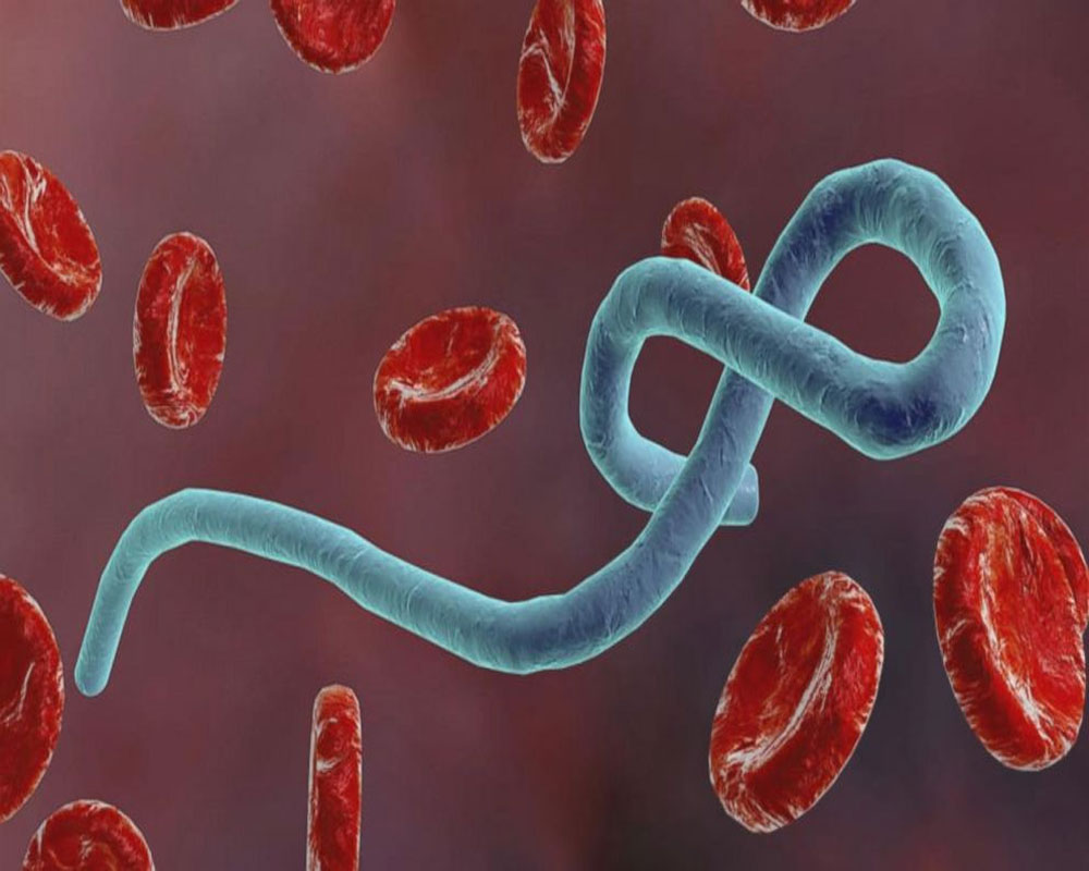 New human protein may help fight Ebola: Study