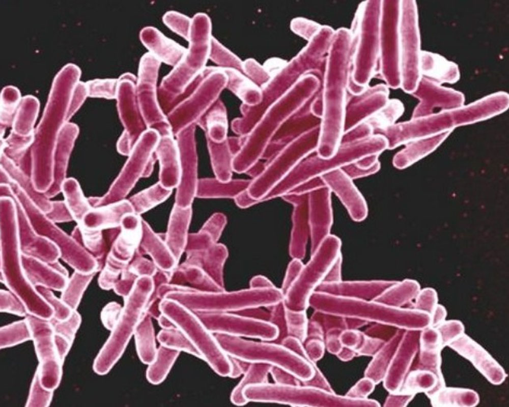 Indian firm develops test to detect drug-resistant TB mutation