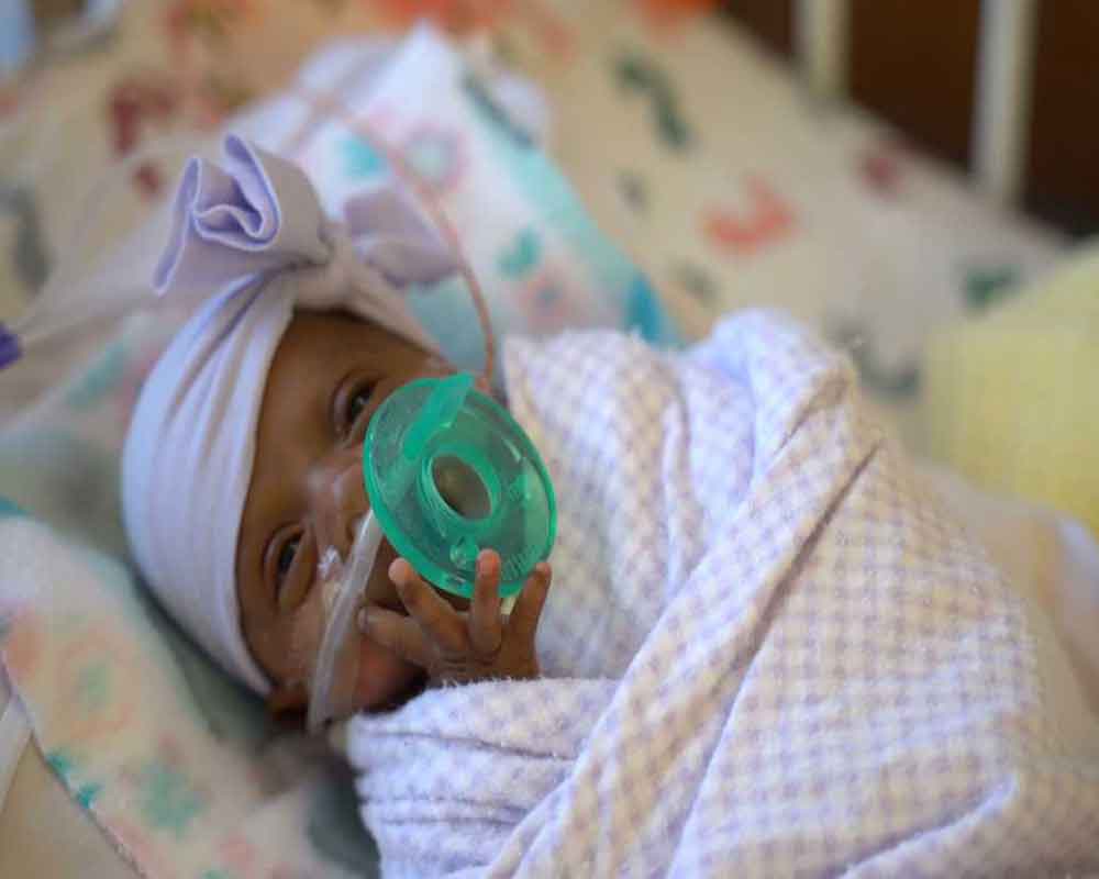 World's tiniest surviving baby born in California