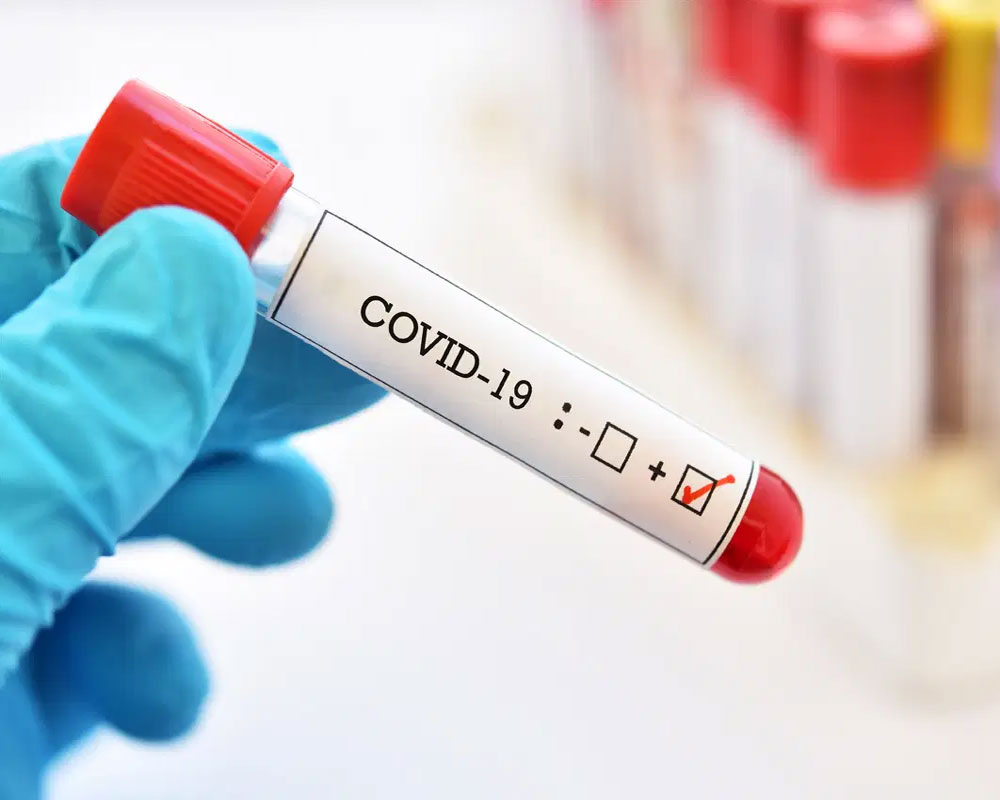 Goa: BJP MLA tests positive for coronavirus