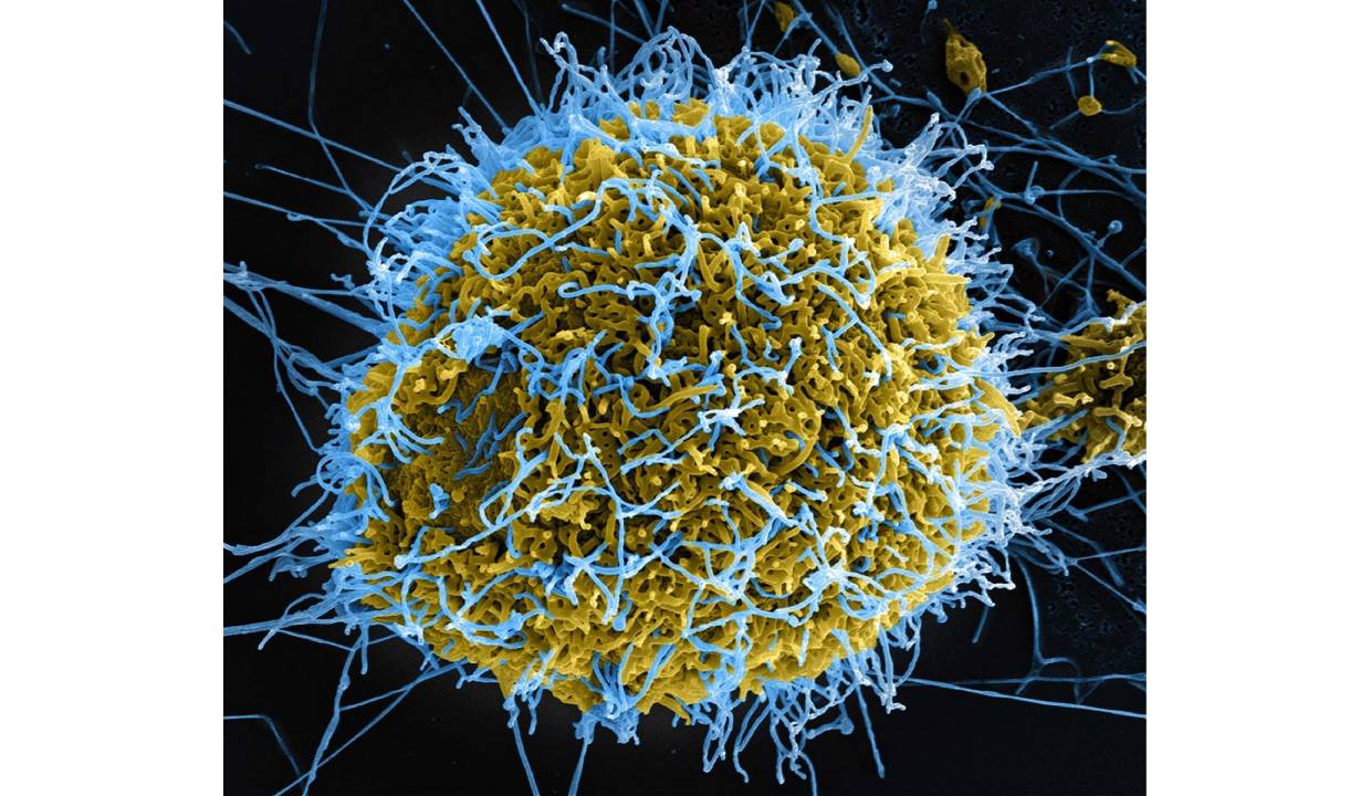 Ebola Outbreak in Congo: over 350 cases, around 120 deaths reported