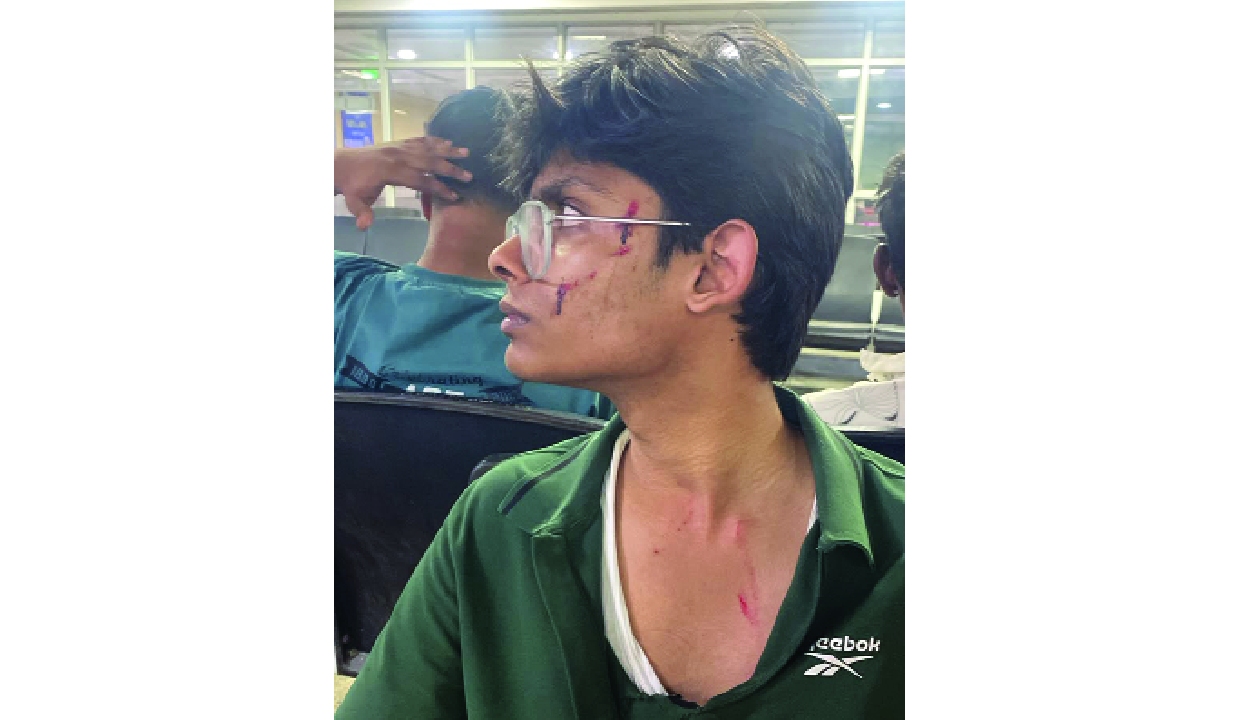 Son of IP University PRO attacked with a blade in Dwarka, no FIR registered yet