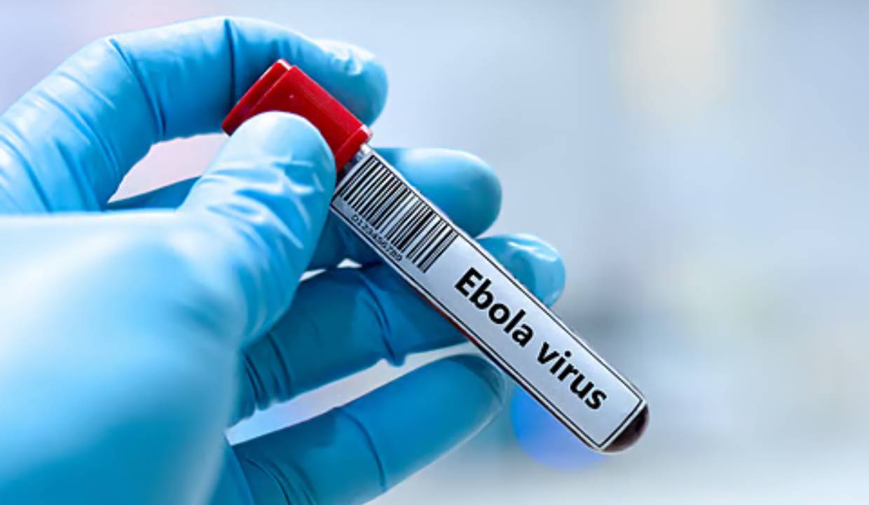 Uganda National in Bengaluru tests negative for Ebola after isolation, Officials confirm