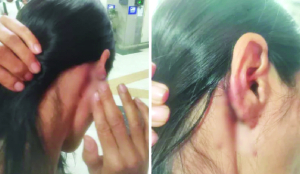 Beaten with belt by group of boys: Manipuri woman on attack in park