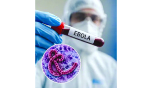 Ebola outbreak: Avoid travel to affected countries, says Health Ministry
