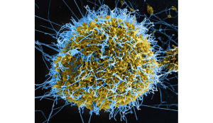 Ebola Outbreak in Congo: over 350 cases, around 120 deaths reported