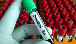 One-third of global 'bad' cholesterol burden occurred in India, China in 2023: Study