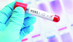 Swine Flu claims woman’s life in MP; Bhopal battles kit shortage