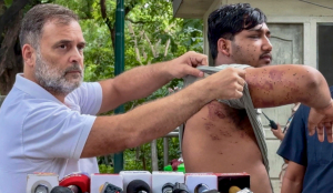 TMC's Derek O'Brien accuses BJP of "cover-up" over pellet gun use on protesters